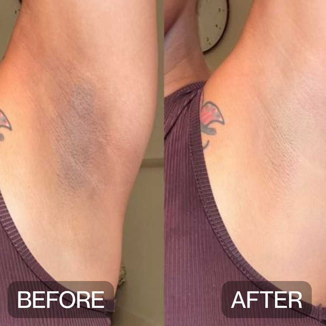 Niptic - Dark Underarm Corrector Deodorant