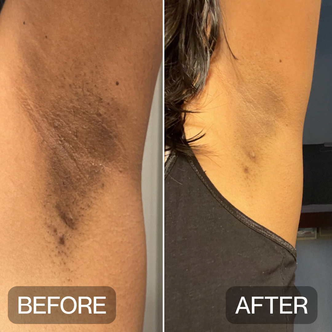 Niptic - Dark Underarm Corrector Deodorant