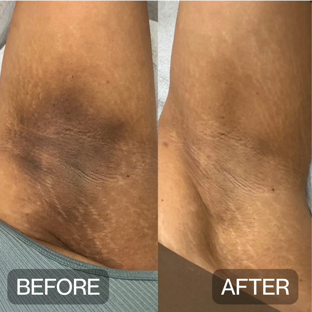 Niptic - Dark Underarm Corrector Deodorant