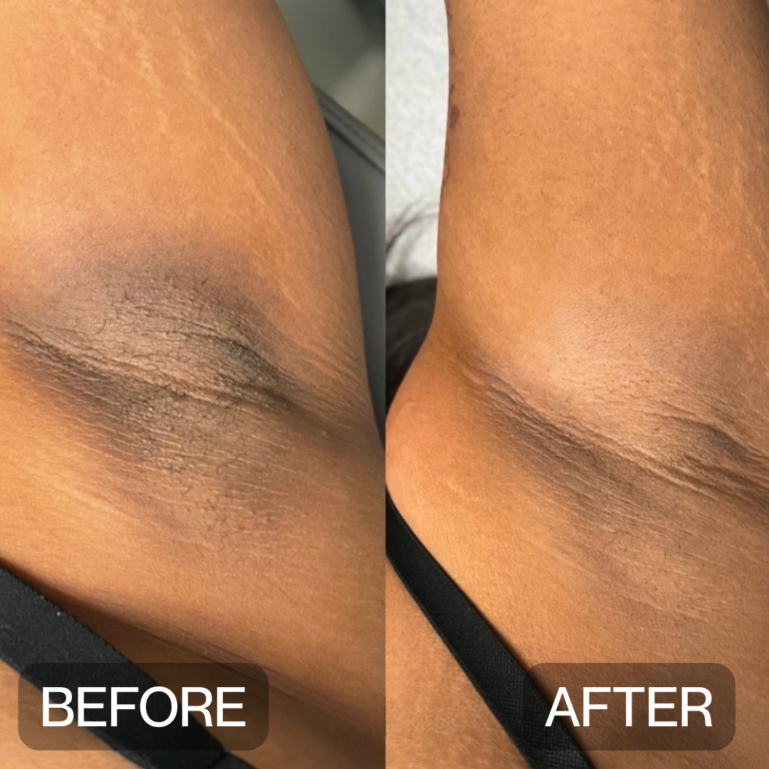 Niptic - Dark Underarm Corrector Deodorant